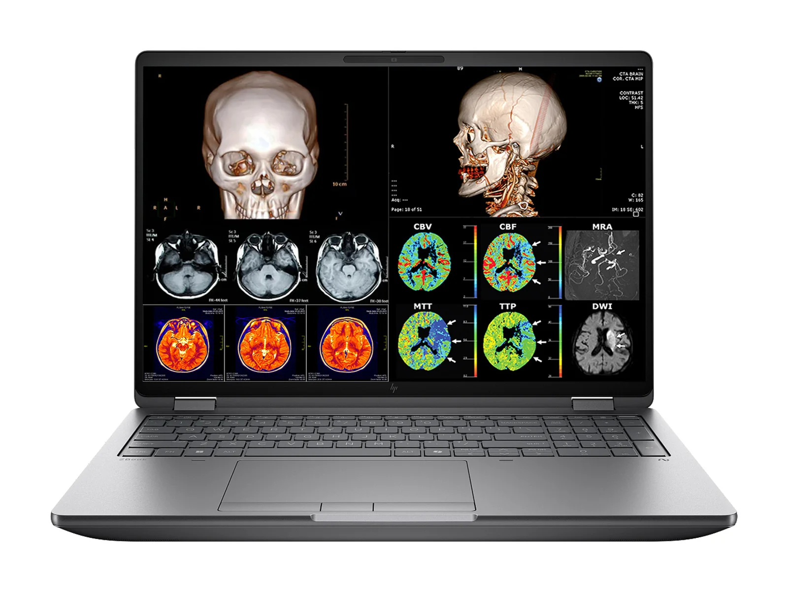 LAPTOP HP ZBOOK FURY G1I 16 INTEL CORE ULTRA 9 285HX / 128GB RAM / 2TB SSD / RTX5000 24GB / PANTALLA 16" FHD+